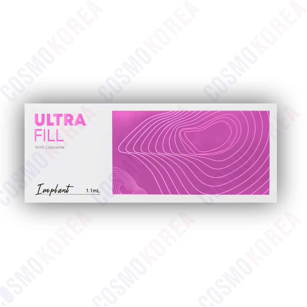 Ultrafill Implant